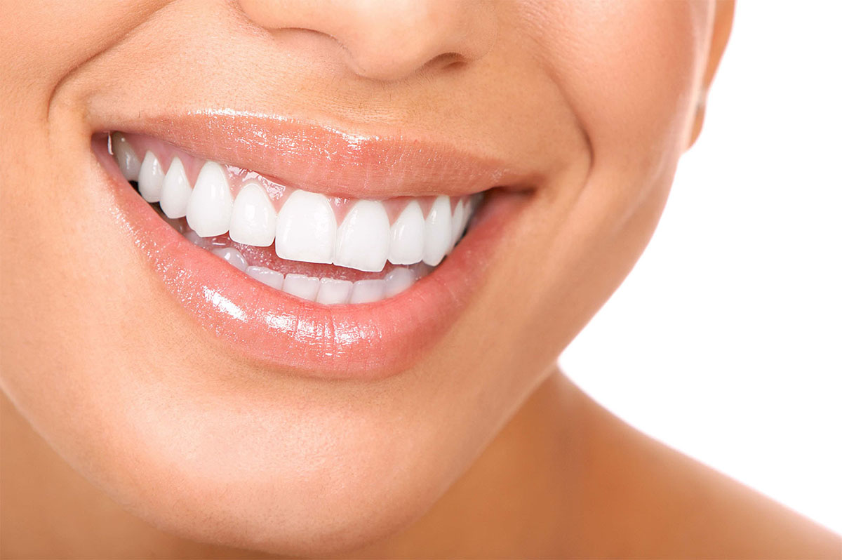 Endure Sheet Ahead Clinica Biodentis Valcea – implantologie / estetica dentara / stomatologie  pediatrica: Inlocuieste-ti un dinte lipsa cu ajutorul unui IMPLANT DENTAR,  FARA DURERE!